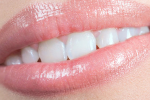 Der richtige Einsatz von medizinischen Methylenblau gegen Stomatitis, Zahnspitzen