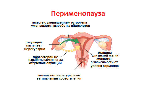 In welchem ​​Alter beginnt die Menopause bei Frauen und was ihre Symptome