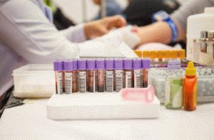 Laboratorijska študija analiz