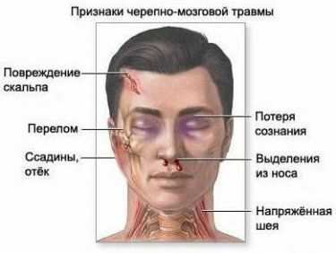 Symptoms of concussion of the brain