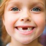 wymiana utraty zębów mlecznych u dzieci w wieku powyżej