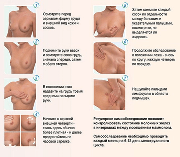 How to treat mastopathy of the breast