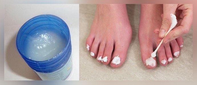 Sulfato de cobre de hongos en las uñas de los pies: baños, ungüentos, compresas.
