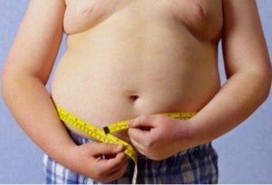 Obesity in humans