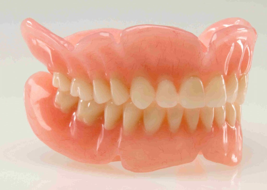 Päällystämällä hammasproteesi: suunnittelu, edut ja haitat