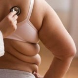 Treatment of overweight and obesity