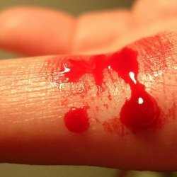 Capillary bleeding first aid