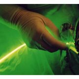 Fotodinamička terapija laserom