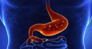 Zenuwgastritis: symptomen en behandeling