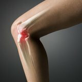 Causes of knee disease