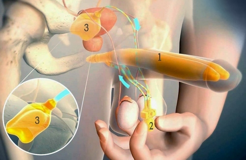 How is the falloprosthesis performed and what is the prognosis of the operation?