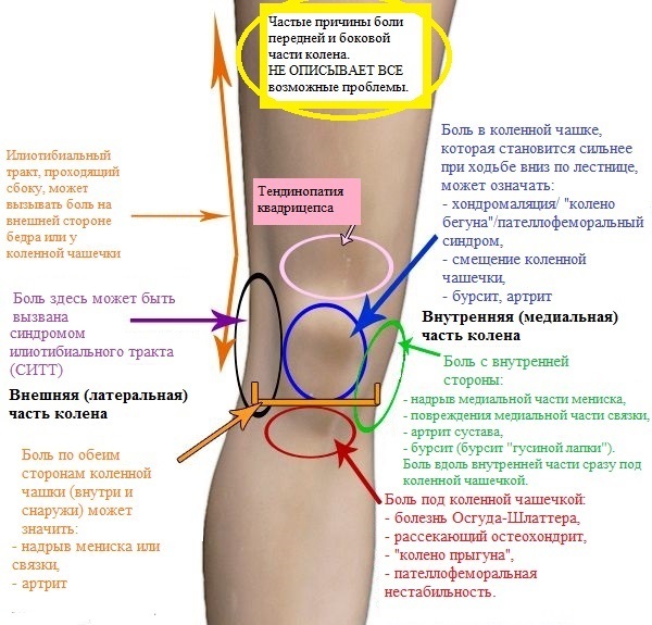 apa yang harus dilakukan jika sakit lutut