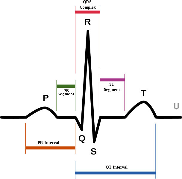 rezultati EKG i moguće metode