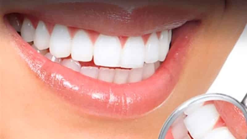 Korrekt bett en person: ett foto av tänderna