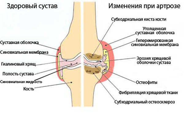 Joint treatment: modern techniques