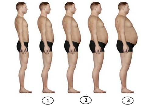 Stages of abdominal obesity