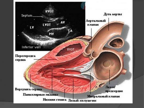 Ultrazvuk obraz srdca, diagnóza srdcového svalu