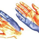 Neuropathy of the ulnar nerve, treatment