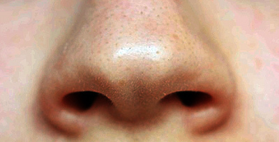 Problem hud i ansiktet