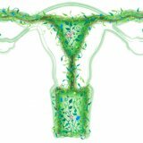 Tradičné metódy liečby vaginózy