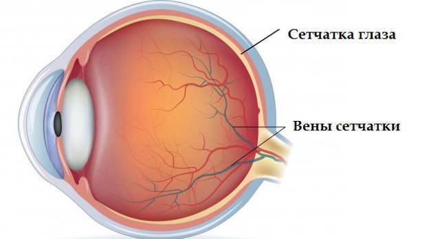 -Eye-retina, diabetische angiopathie