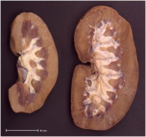 Hipertrofija notranjih organov