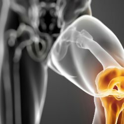 Causes of arthrosis