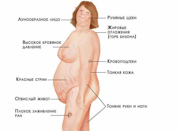 Tumors of the adrenal glands: symptoms, diagnosis, treatment( removal)