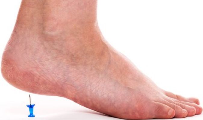 Akutte smerter kan sammenlignes med en spiker i hælen