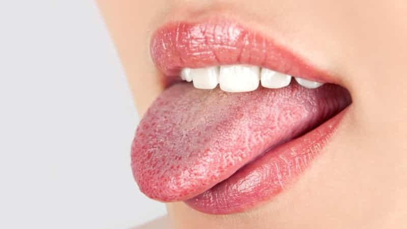 bolesti usne šupljine u odrasloj slici