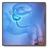 Asymptomatische Entzündung der Prostata