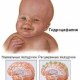 Neugeborene Hirnrinde