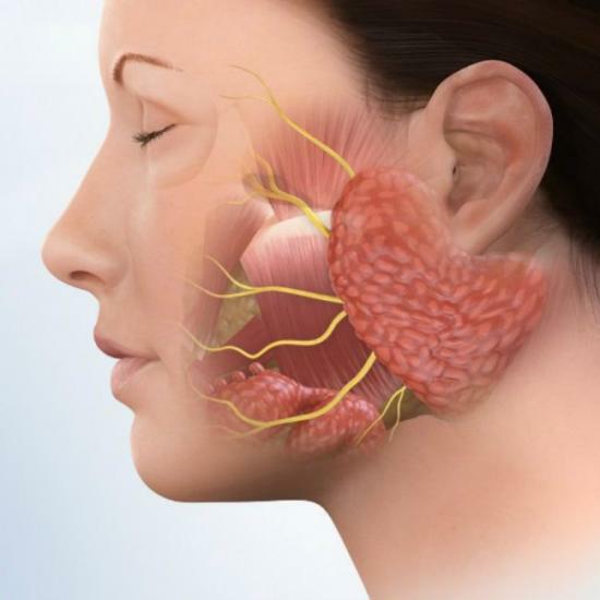 Mumps disease symptoms