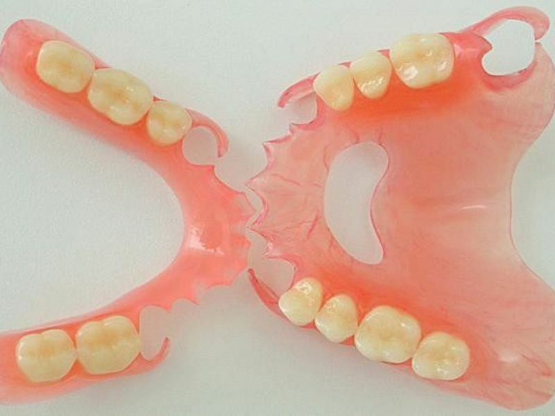 Jak dlouho jsou vyrobeny z nylonu zubní protézy