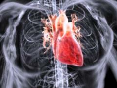 postmiokardichesky cardio