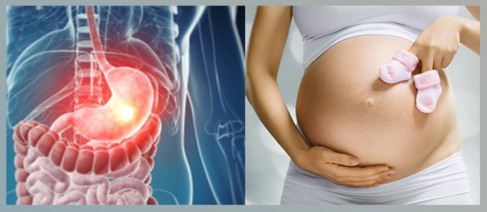 Ziekten van het spijsverteringskanaal, zwangerschap