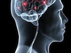In Chiari-Syndrom, beeinträchtigte Gehirnstruktur
