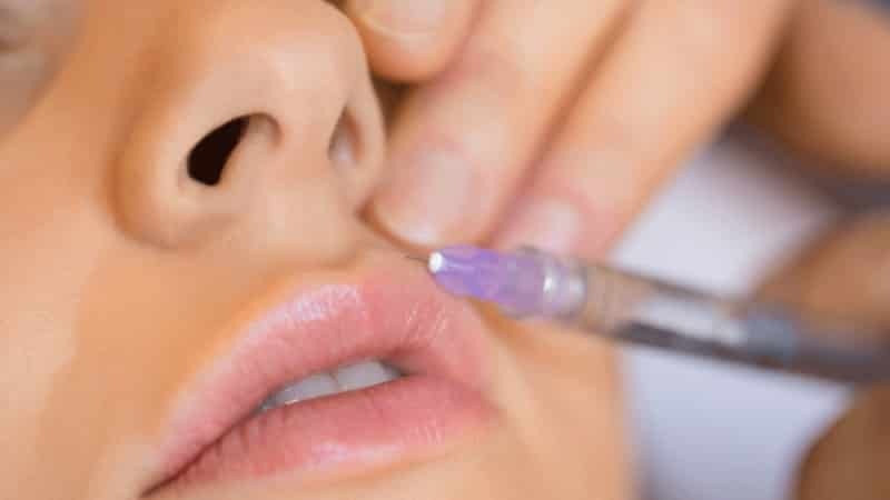 los efectos de aumento de labios con ácido hialurónico