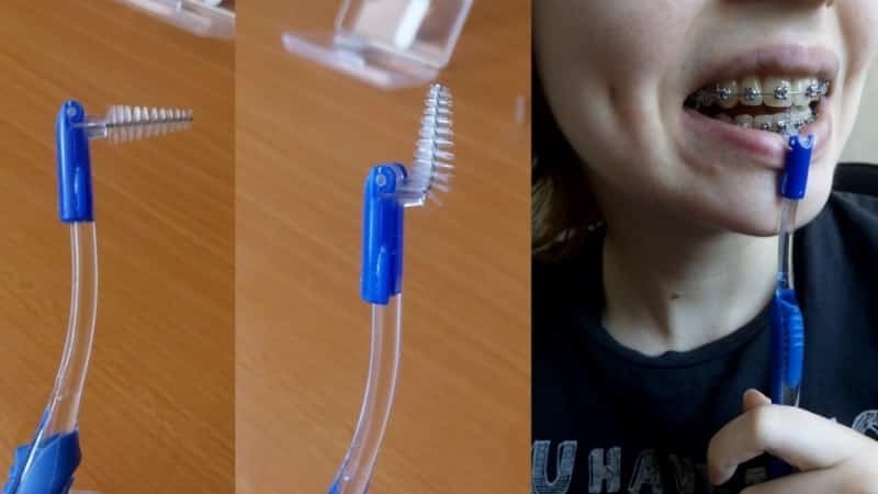 mechanische Reinigung der Zähne von Plaque