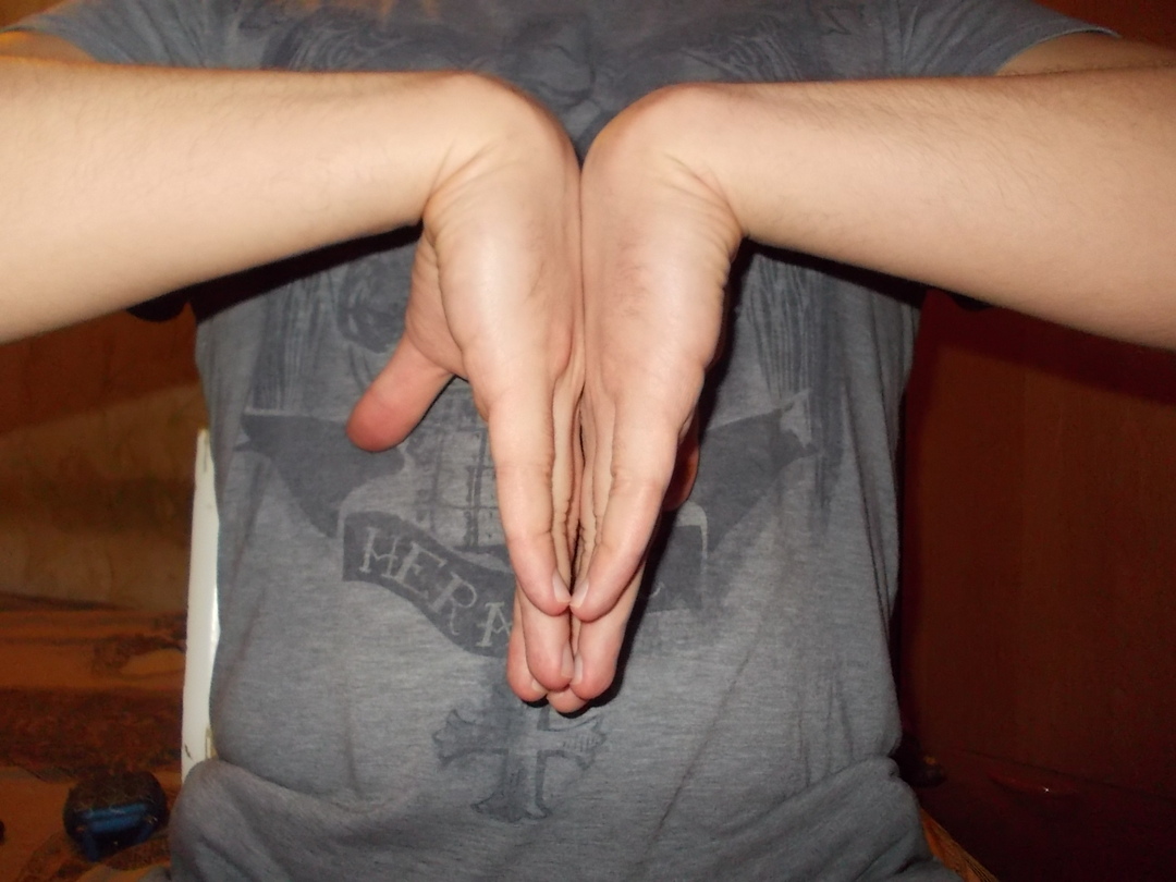 kéztőcsatorna szindróma( alagút szindróma) a tünetek és a kezelés