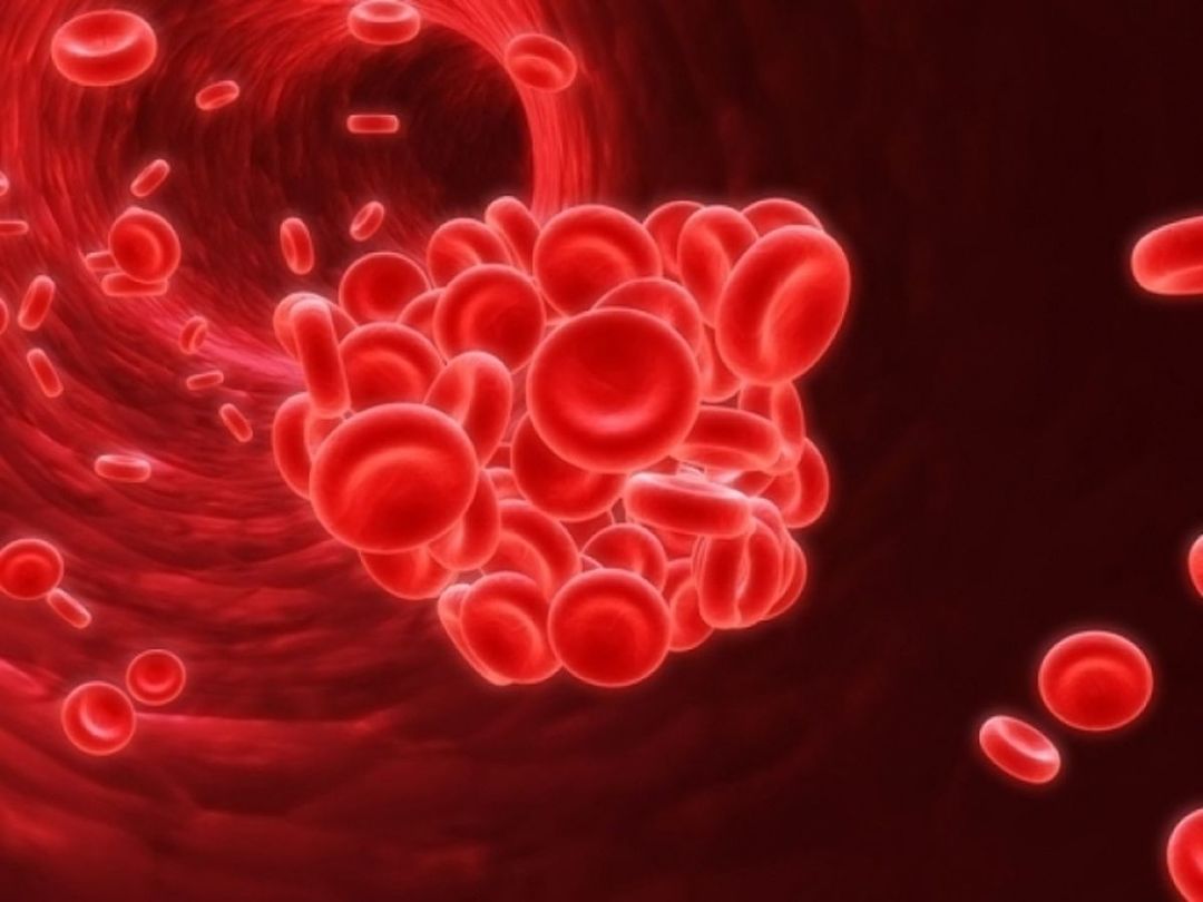 Krvni ugrušak u srcu: što je to, kako nastaju krvni ugrušci u krvnim žilama i kako ih izbjeći