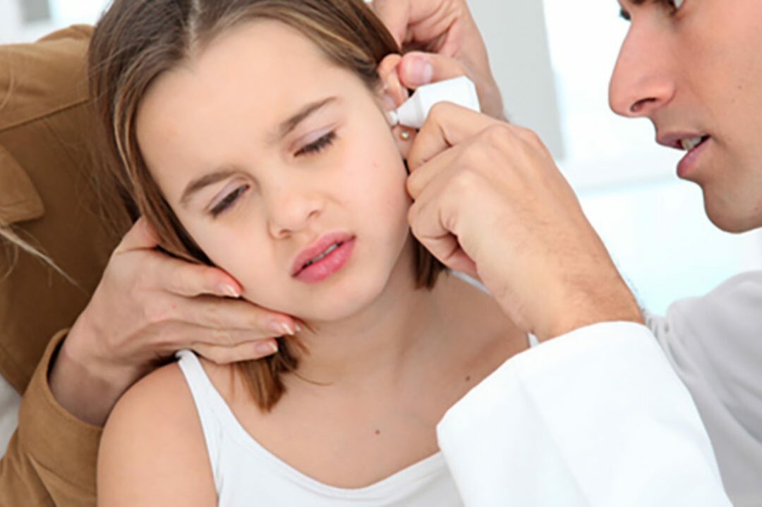 Acute otitis media: what is it, symptoms and treatment, prevention
