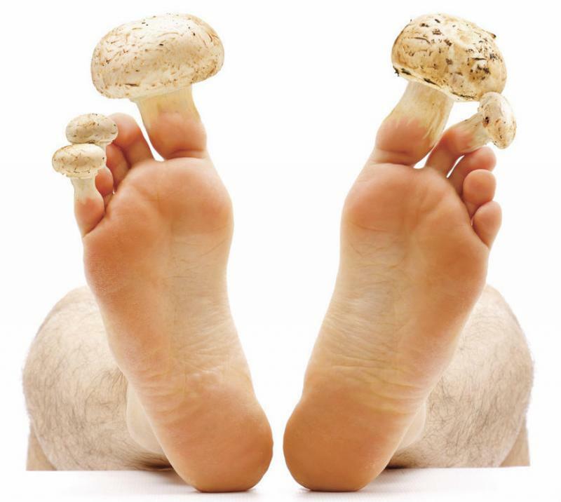 Liječenje gljivične nokte na nogama narodnih lijekova