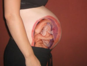Utérus de la femme enceinte