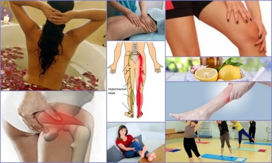 Hvordan man behandler en klemt nerve i hofteleddet: medicin, folkemusik recepter, fysioterapi, massage, ernæring, kirurgi