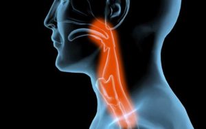 Dysphagia: típusok, okok, tünetek, kezelés és fokok