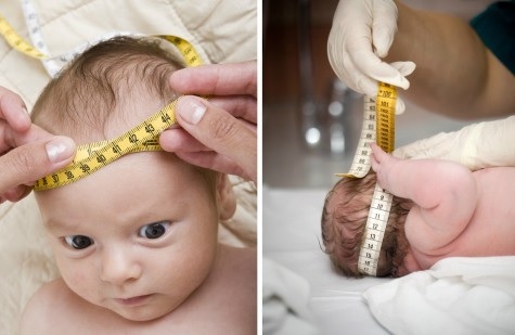 Objawy ciśnienia śródczaszkowego u niemowląt