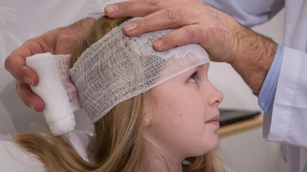Diakarb v možganih pretres možganov pri otrocih
