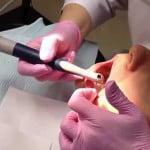 Tandköttsproblem och metoder för att behandla