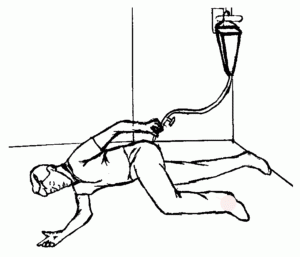 Enema para disbiose